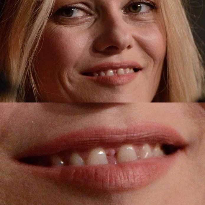 Зубы Ванесса Паради