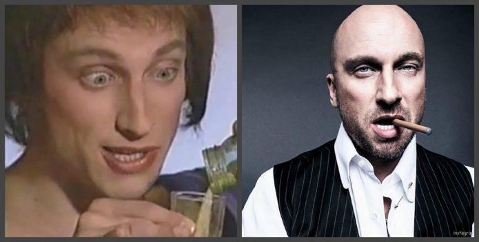 Дмитрий Нагиев зубы до и после