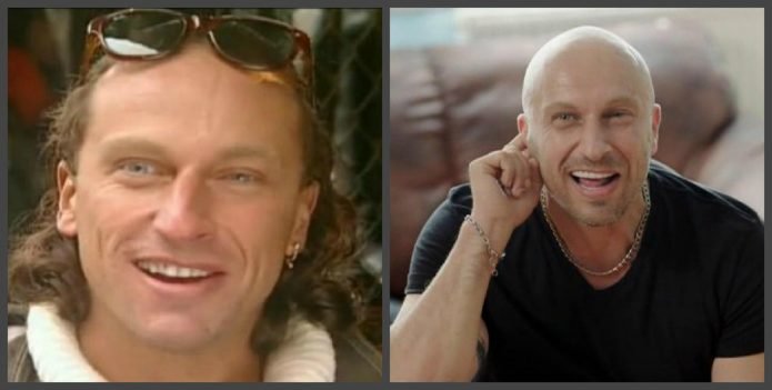 Дмитрий Нагиев зубы до и после