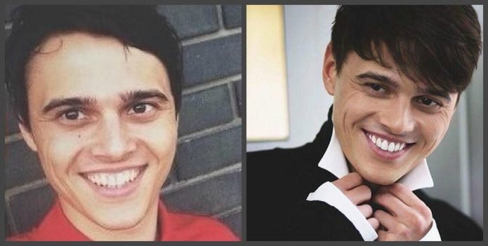 Алексеев зубы до и после