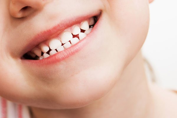 Особенности и преимущества лечения детских молочных зубов