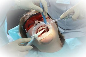 Как ппроводится процедура отбеливания зубов