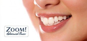 Методика отбеливания зубов