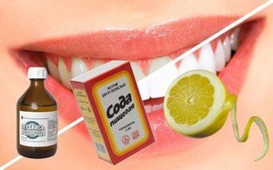 Как в домашних условиях отбелить зубы