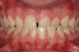 Причины и показания для обращения к врачу ортодонту-стоматологу
