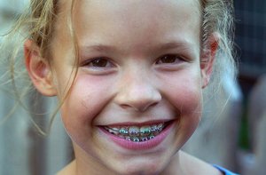 Методы работы детского ортодонта-стоматолога