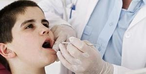Санация полости рта