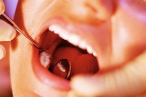 Как недорого вставить зуб