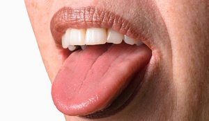Диагностика заболеваний по налету на языке