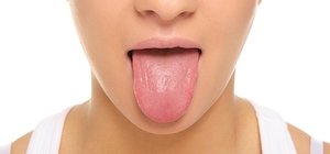 Глоссит - заболевание языка