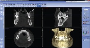 Телеренгенограмма зубов и челюсти перед приемом у стоматолога