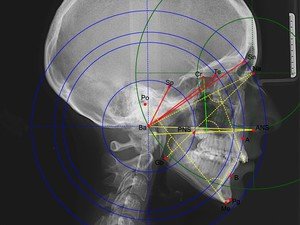 Телерентгенограмма - фото головы человека