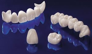 Безметалловая керамика в стоматологии - варианты коронок