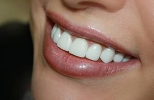 Коронки на зубах могут выглядеть естественно