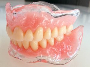 Особенности нейлоновых зубных протезов