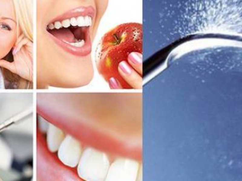 Особенности чистки зубов ультразвуком
