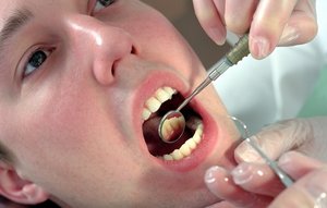 Парадонтоз: как спасти зубы и какие лекарства помогают