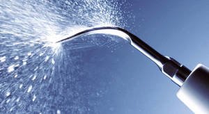 Air-flow - это метод чистки зубов без применения активных химических средств