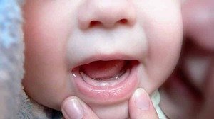 Появление первых зубов может сопровождаться разными симптомами
