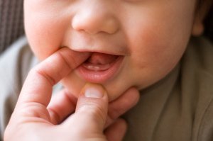 Какими способами помочь ребенку при прорезывании зубов