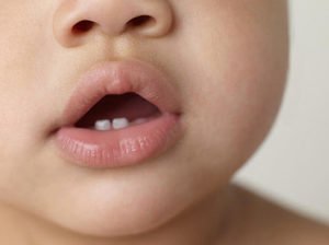 Симптомы прорезывании зубов у малышей