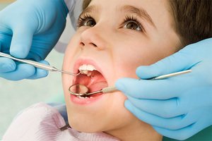 Как лечить кариес молочных зубов у детей