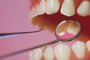 Использование мышьяка в стоматологии