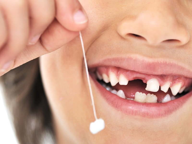 Порядок смены молочных зубов