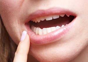 Как можно вылечить губы от язв