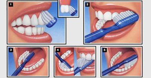 Чистка зубов - последовательность действий по совету стоматолога