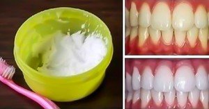 Как эффективно отбелить зубы в домашних условиях