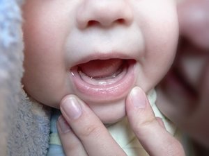 Очерёдность прорезывания зубов у грудничков