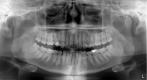 Цифровой снимок зубов
