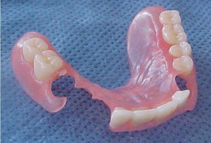 Нейлоновые зубные протезы: особенности и преимущества, цены и отзывы