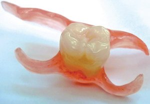 Съемные зубные протезы - особенности и материалы