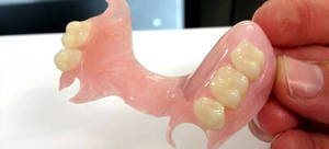 Как выглядит акриловый зубной протез
