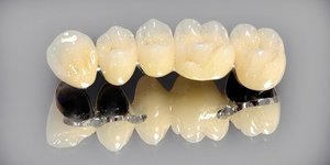 Характеристика металлокерамических коронок для зубов
