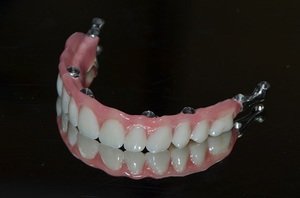 Описание несъёмных зубных протезов