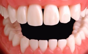 Классификация зубов человека