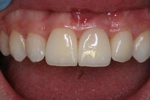 Особенности гистологического строения зубов человека