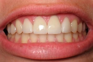Зубы человека, составляющие зубной ряд