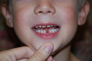Строение и особенности молочных зубов