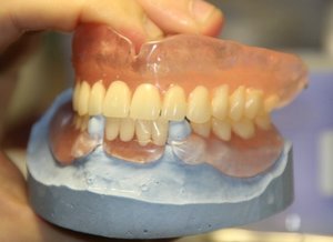 Зубные протезы съемные и несъемные