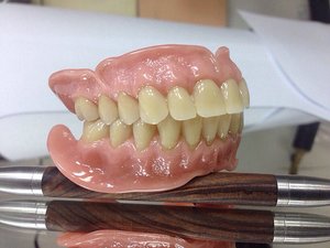 Съемные зубные протезы Акри-Фри - преимщества