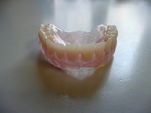 Протезирование зубов - особенности съемных протезов