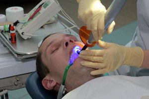 Профилактика и методы лечения кариеса на зубах