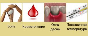Осложнения роста зуба мудрости могут быть разными, чаще всего при этом зуб просто удаляют.
