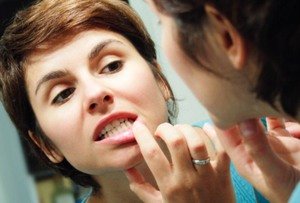 Симптомы и лечение альвеолита после удаления зуба