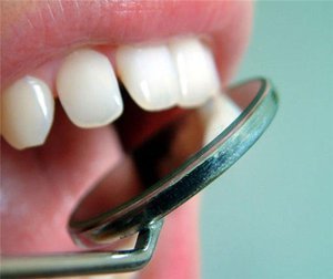 Показатели на удаления зуба