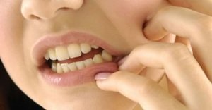 После удаления корня зуба, лунку надо обязательно обработать, чтоы избежать воспалительных и инфекционных процессов